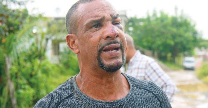 Herido en asalto en que murió seguridad de Jean Alain narra cómo sobrevivió