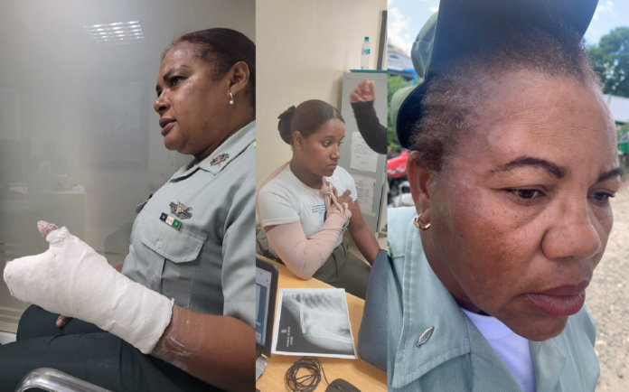 La coronel del canódromo aparece con un yeso; otras agentes muestran golpes