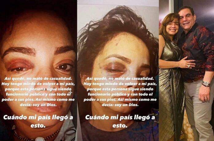 Exesposa del superintendente de Pensiones lo acusa de golpearla y dice temer por su vida