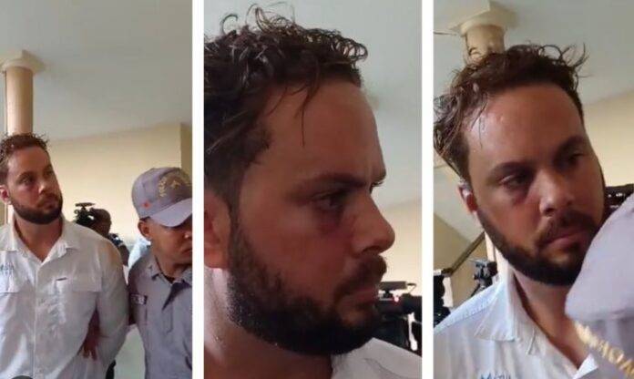 Otro preso golpeó y dejó moretones al cubano que agredió agente de Digesett