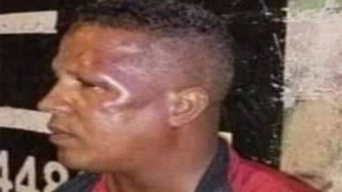 Dirigente del PRM presuntamente golpea a un camarógrafo