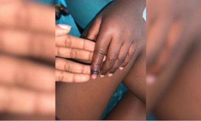 Madre denuncia profesora casi le corta un dedo a su hijo al estrellarle una puerta