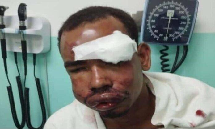 Haitianos agreden a dos jóvenes dominicanos en la frontera de Dajabón