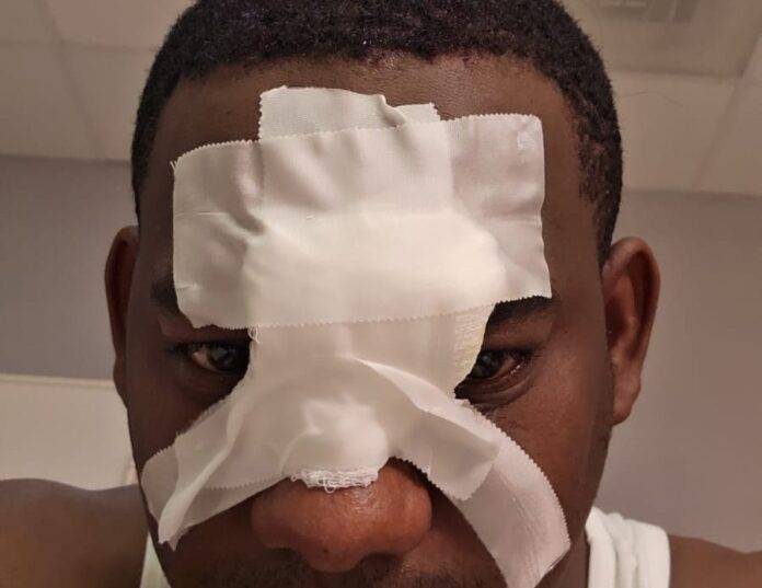 Inmigrante haitiano ataca violentamente a conductor de Migración en Higüey