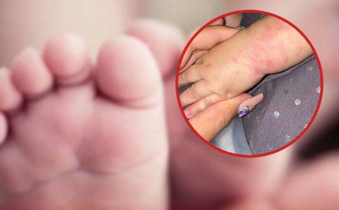 Denuncian supuesto maltrato a una bebé de 11 meses en una guardería de La Vega