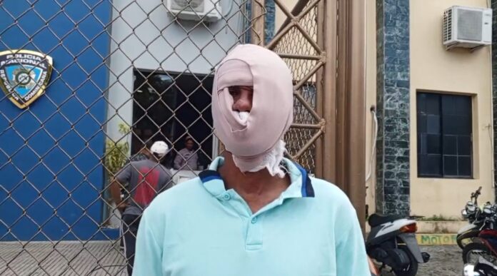 Denuncian agresión con sancocho caliente en La Vega: joven acusa a dueño de Rancho Novato de quemarlo en el rostro