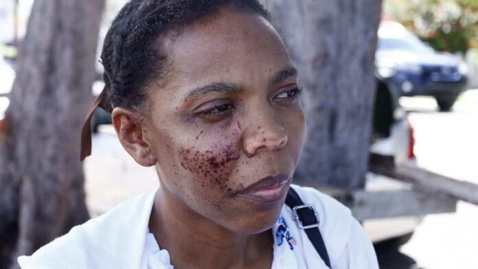 Comerciante asesinado al intentar impedir asalto en su vivienda de Santo Domingo Norte