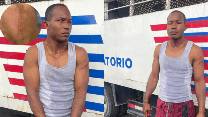 Agente de Migración resulta herido durante operativo en Baní; agresor fue detenido