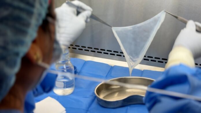 Salud Pública anuncia la creación de un banco de piel y tejidos para pacientes quemados