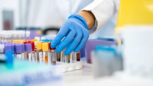 Desarrollan un test para detectar el cáncer de páncreas mediante una muestra de sangre