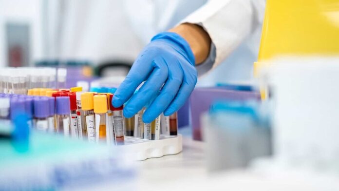 Desarrollan un test para detectar el cáncer de páncreas mediante una muestra de sangre